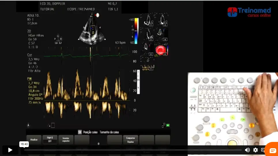 Tutorial de Recursos Avançados para o Ecocardiografista